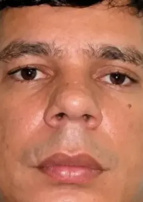 Caso Marcos Karatê: PGE mantém demissão de policial condenado