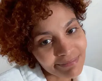Barbara Reis revela cirurgia para lipedema: "Realização de um sonho"