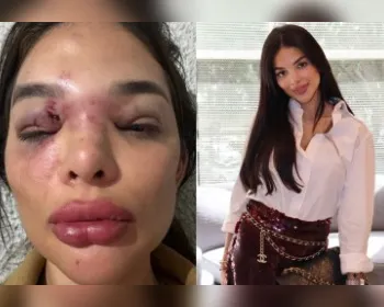 Dentista agredida por empresário da Faria Lima: "Não foi a primeira vez"
