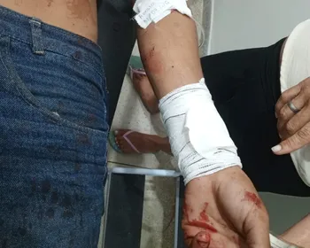 Homem é esfaqueado no peito e suspeito é localizado pela Guarda Municipal