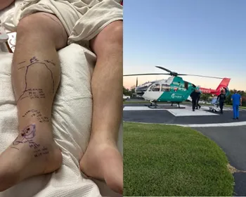 Homem leva duas picadas de cascavel e esgota o soro de hospital