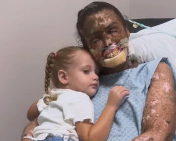 Morre Karine Felipe, influencer que lutava contra doença rara