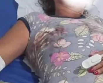 Mulher dá entrada em hospital de Arapiraca após ser espancada; marido é suspeito
