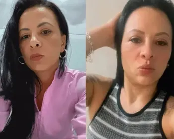 Mulher morre após ter intestino perfurado durante exame de colonoscopia em hospital