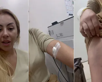 Pastora Renata Vieira exibe hematomas em polêmica com entregador