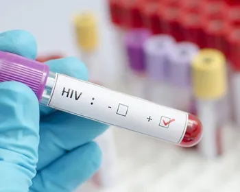 Tenente do Exército perde posto após condenação por transmitir HIV a duas mulheres