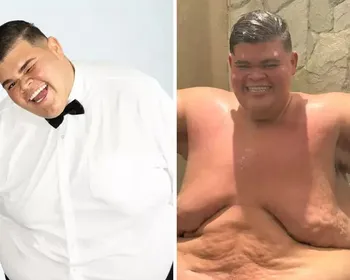 Veja o antes e depois do influenciador Gordão da XJ após perder 130 kg