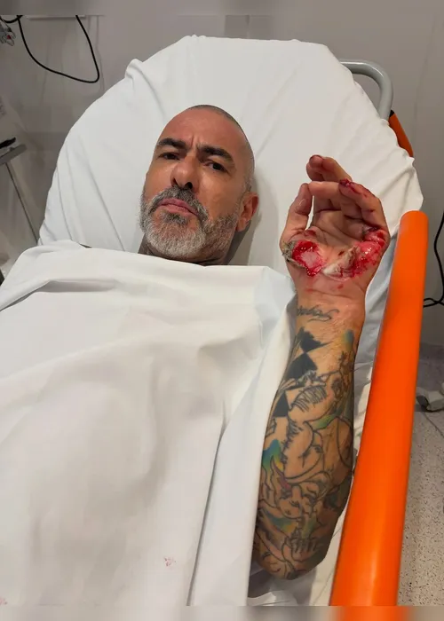 
				Henrique Fogaça volta ao MasterChef após acidente de moto
			
			