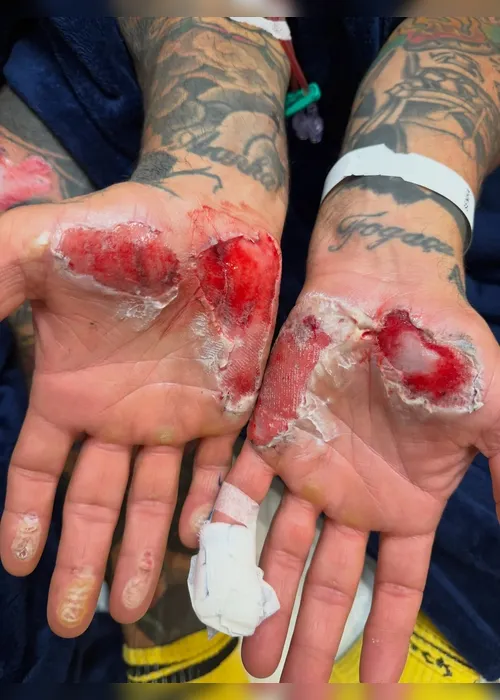 
				Henrique Fogaça volta ao MasterChef após acidente de moto
			
			