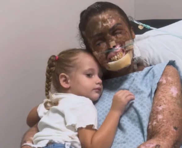 Morre Karine Felipe, influencer que lutava contra doença rara