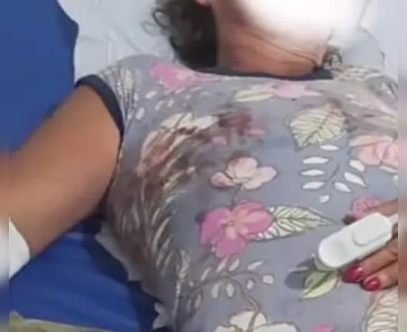 Mulher dá entrada em hospital de Arapiraca após ser espancada; marido é suspeito