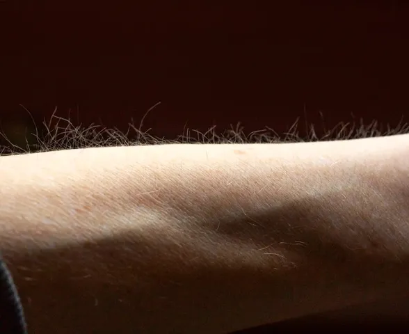 Pelos da pele podem ajudar o corpo a detectar coceira, sugere estudo
