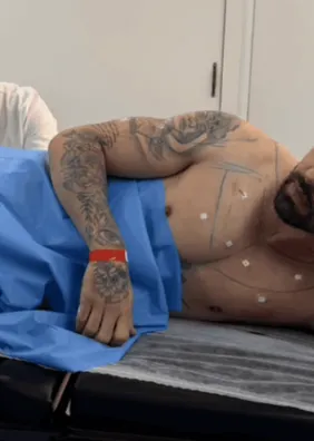"Cutox": médico explica procedimento anal realizado por Rico Melquiades