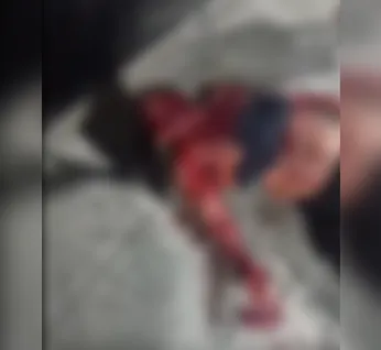Homem fica em estado grave após ser atingido por prato durante discussão