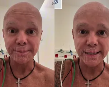 Cantor Netinho é internado após volta do câncer; saiba estado de saúde