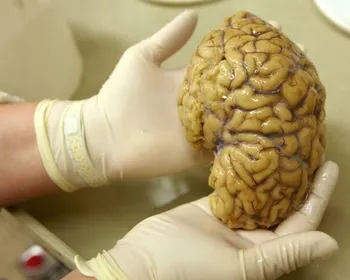 Cientistas mapeiam atividade gênica no córtex pré-frontal do cérebro, em busca de repostas para Alzheimer, Parkinson e esquizofrenia