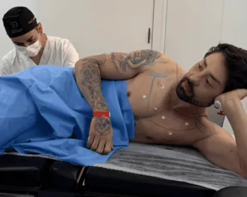 "Cutox": médico explica procedimento anal realizado por Rico Melquiades