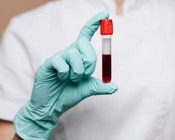 Estudo investiga se há risco de transmissão do Alzheimer pelo sangue