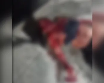 Homem fica em estado grave após ser atingido por prato durante discussão