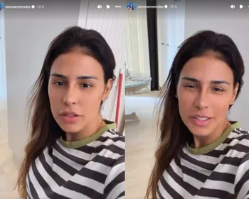Sem mencionar recuperação, Simone Mendes exibe resultado de procedimento no nariz