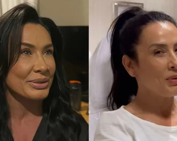 Voltaram atrás: 7 famosas que reverteram procedimentos faciais
