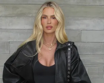 Yasmin Brunet desabafa ao falar sobre efeitos do lipedema: "Dor e queimação"
