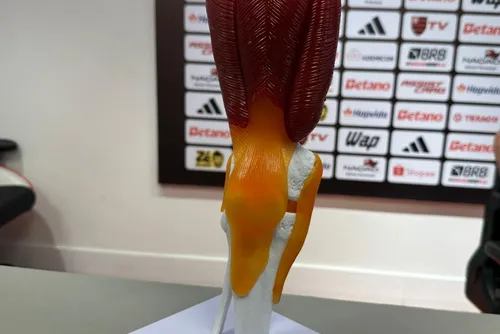 
				Caso Plata: entenda o que alegou clube russo e veja explicação do Flamengo
			
			