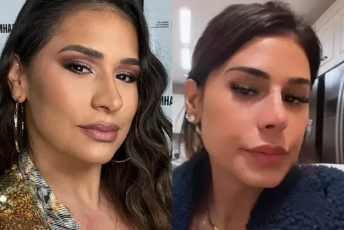 
				Simone "amarra" fios no nariz em novo procedimento; veja como ficou!
			
			