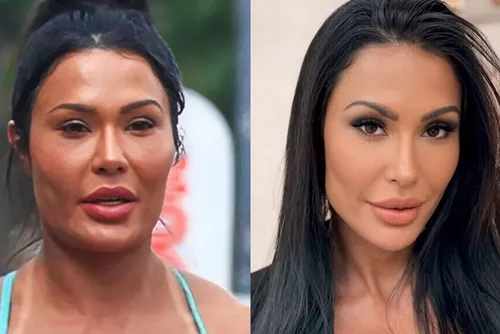 
				Voltaram atrás: 7 famosas que reverteram procedimentos faciais
			
			