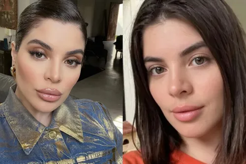 
				Voltaram atrás: 7 famosas que reverteram procedimentos faciais
			
			
