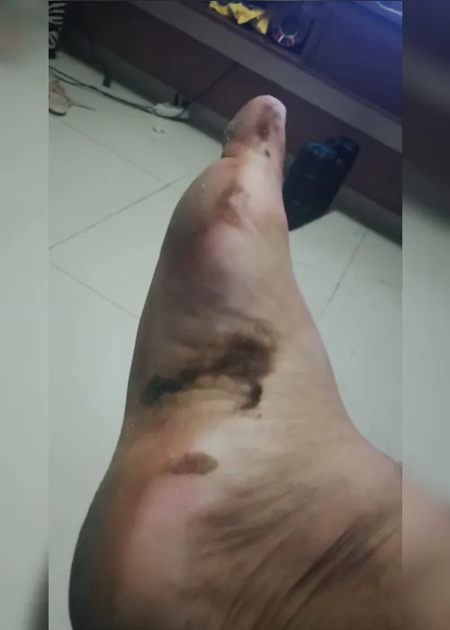 
				Manchas de óleo são registradas no litoral sul de AL um dia após ocorrência em Maceió
			
			