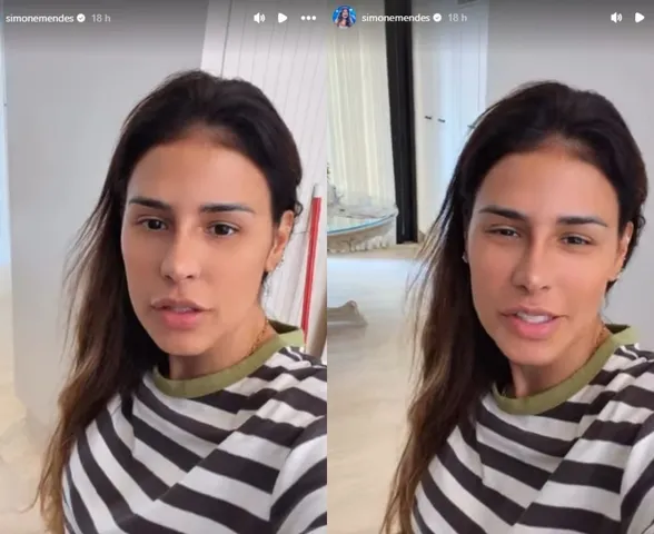 Sem mencionar recuperação, Simone Mendes exibe resultado de procedimento no nariz