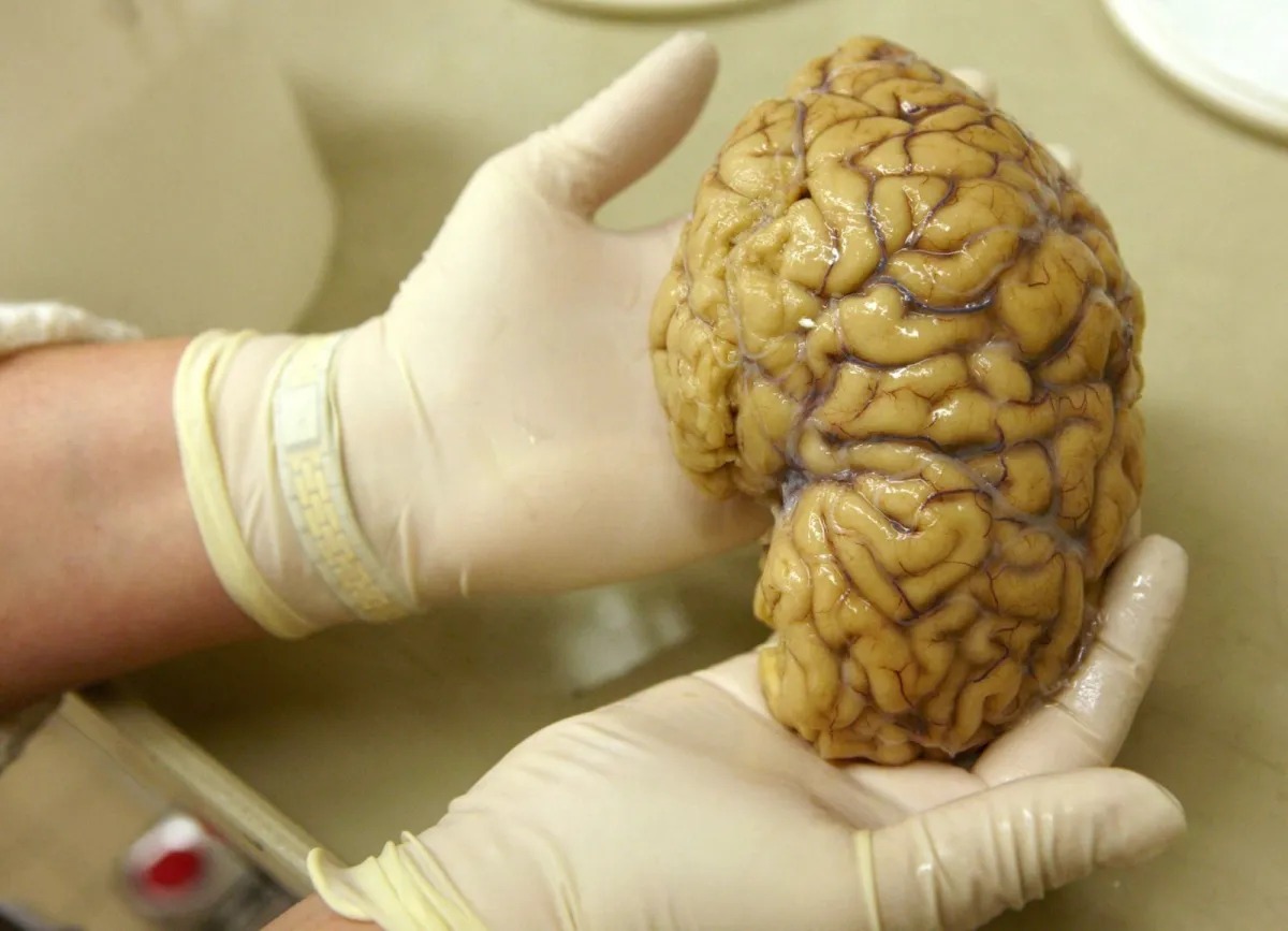 Cientistas mapeiam atividade gênica no córtex pré-frontal do cérebro, em busca de repostas para Alzheimer, Parkinson e esquizofrenia