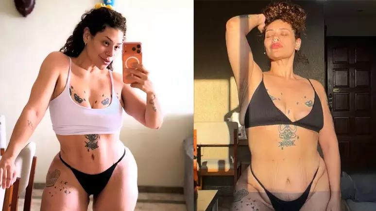 Ex-'The Voice', Aila Menezes mostra resultado de abdominoplastia e celebra reencontro com o próprio corpo após perder 90 kg