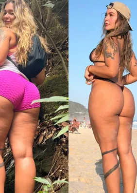 Atual Miss Bumbum conta que descobriu lipedema após ver foto tirada durante trilha “susto”
