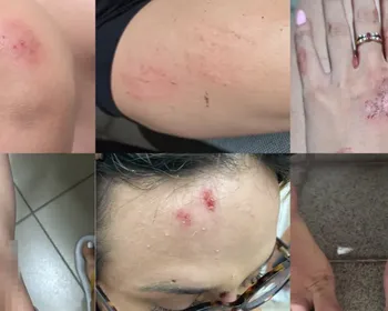 Justiça nega prisão de acusado de agredir influencer em Maceió