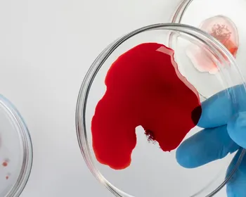 Jejum antes do exame de sangue pode não fazer diferença, sugere estudo