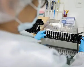 Malária: Anvisa autoriza teste em humanos de vacina 100% brasileira