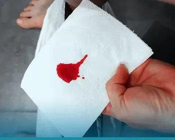 Sangue nas fezes nem sempre é câncer, mas precisa de investigação