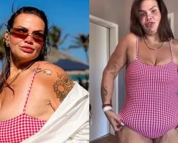 Thais Carla fala sobre excesso de pele após perder 120 kg: ‘Não deixo de viver’