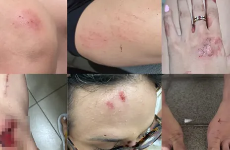 Influencer agredida: veja nota na íntegra de entidade após vítima ser arrastada por ex-companheiro