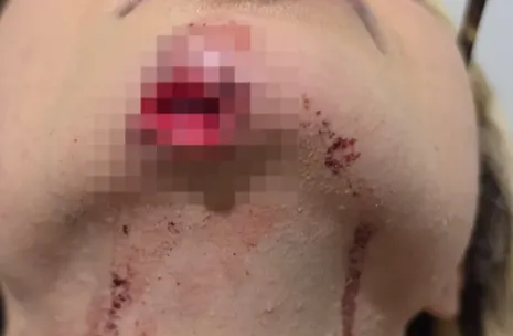 Influencer agredida: veja nota na íntegra de entidade após vítima ser arrastada por ex-companheiro