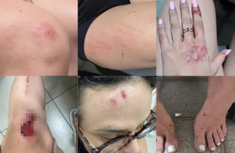Influenciadora arrastada por carro em Maceió já tinha medida protetiva, diz entidade