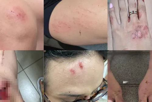 
				Influencer agredida: veja nota na íntegra de entidade após vítima ser arrastada por ex-companheiro
			
			
