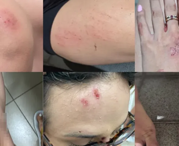Justiça nega prisão de acusado de agredir influencer em Maceió