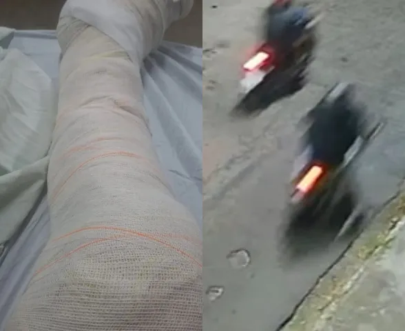 PC analisa imagens para identificar trio que assaltou motociclista por aplicativo no Poço