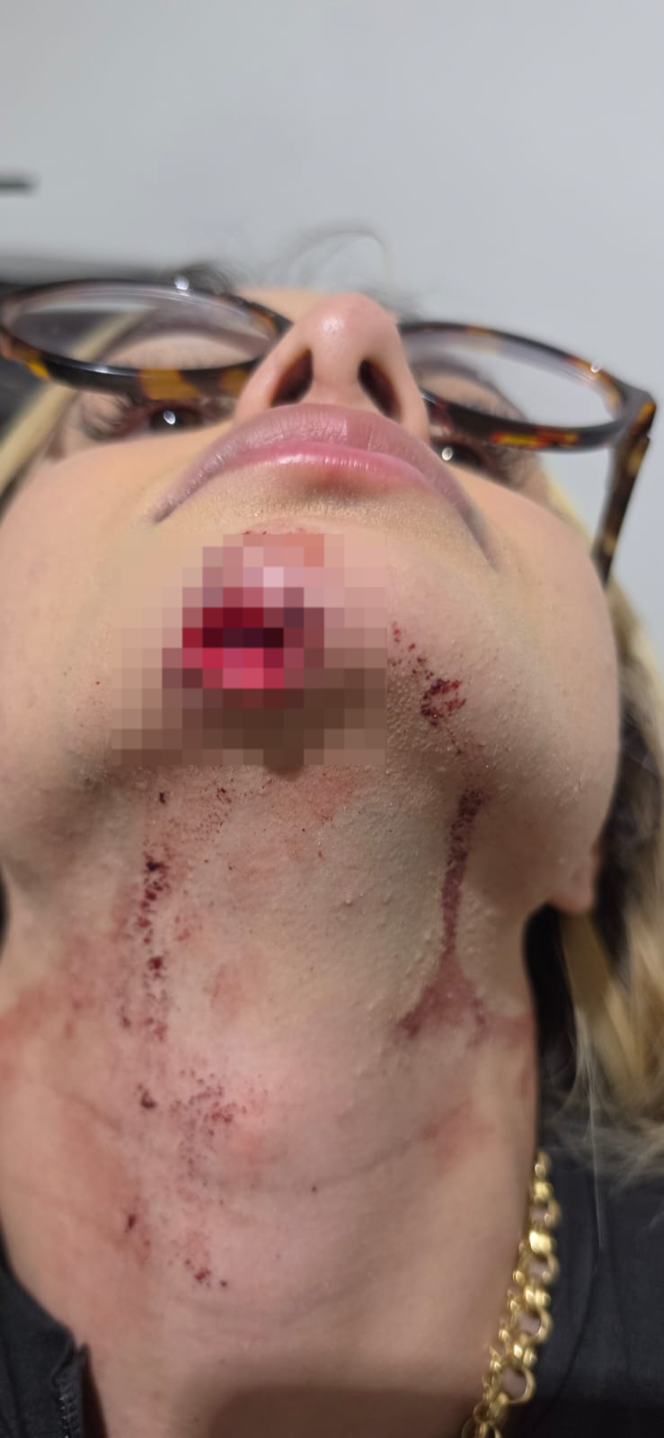 Influenciadora de Maceió relata agressão do ex e diz ter sido arrastada em carro por 100 metros