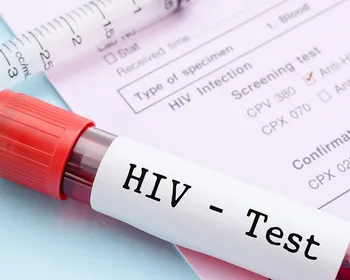 Alagoas registra alta nos diagnósticos de HIV e avanço da aids, aponta Sesau