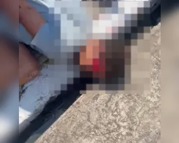 Homem é atropelado e agredido após tentativa de furto de bicicleta