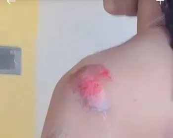 Jovem pula de moto por app após suspeitar de tentativa de estupro 